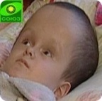 Лечение Тимура Акижанова оплачено