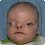 Обследование Вани Муковоза