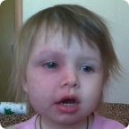 Оплачен счет за лечение Маши Андрюшиной