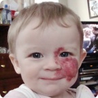 Лечение Саши Барсуковой оплачено