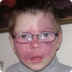 Собрали на лазер