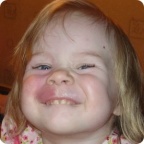 Даша Захаркина после второй процедуры лечения