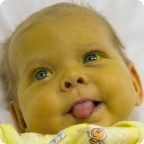 Дашеньку Чибисову выписали из больницы