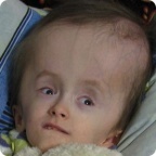 Оля Пипич. Операция позади