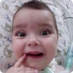 Расходные материалы к аппарату ИВЛ Мурата Саргсяна