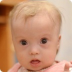 Надя Федоренко. Операцию оплатил другой фонд