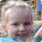 Лечение светом