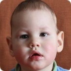 Оплачен первый курс реабилитации Льва Бельского